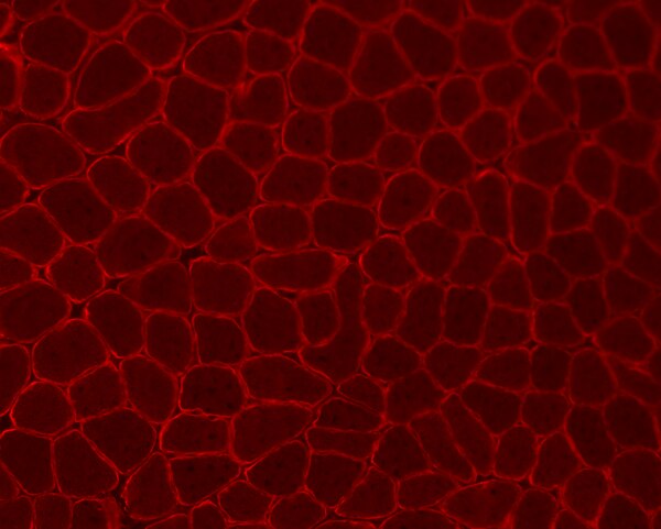 Immunohistochemistry (IHC) image of wild-type mouse gastrocnemius muscle sections labeled with DSHB anti-dystrophin [10F9]. PMID: 39034316, Fig. 3B